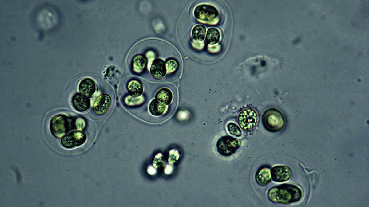 Microscope image of blue-green algae cyanobacteria gloeocapsa