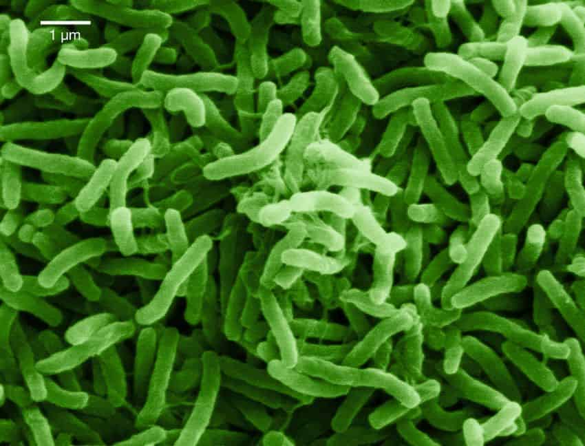 A microscope image of thousands of rod-shaped bacteria, vibrio cholerae, coloured green