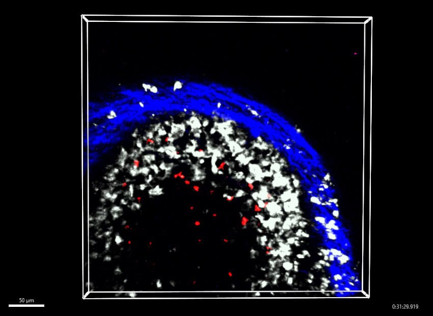 A fluorescent microscope image of a lymph node showing red cells interacting with white cells