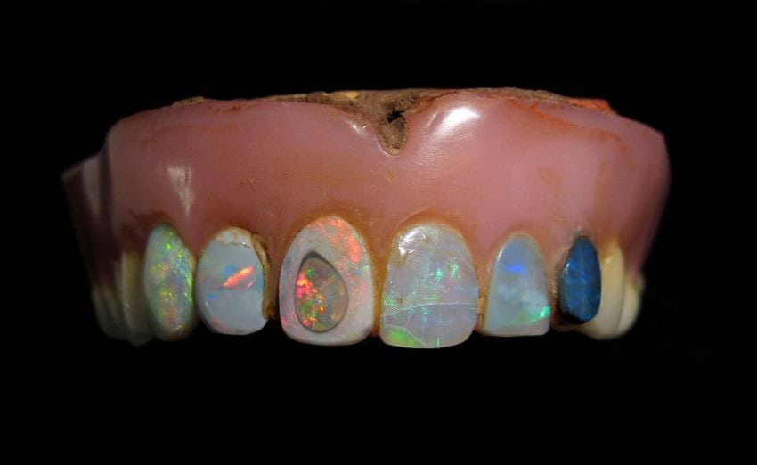 Top denture plate with opal teeth.