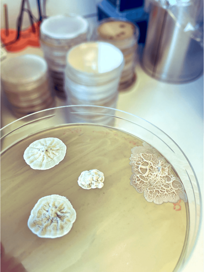 Petri dish containing bacteria.