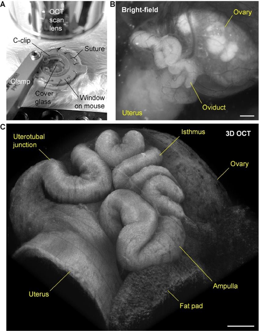 A collection of three images. The first shows a small circular window implanted into the skin of a mouse. The second shows a 2d greyscale image of an ovary, fallopian tube, and uterus. The third is a highly detailed 3d image of the organs.