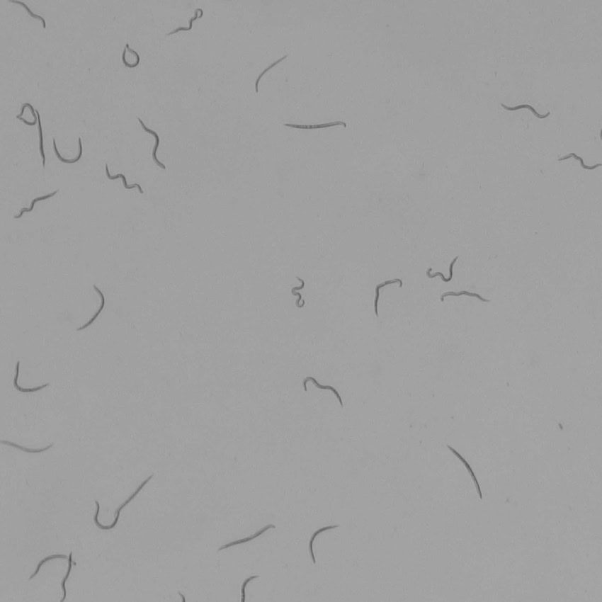 A grey scale image showing several tiny worms