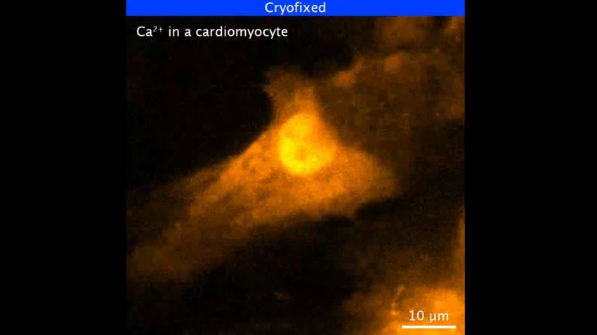 A still image of a wave of orange light propagating through a heart cell under the microscope