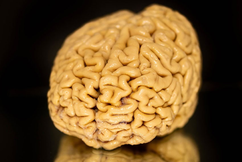 A preserved human brain sitting on a black reflective surface