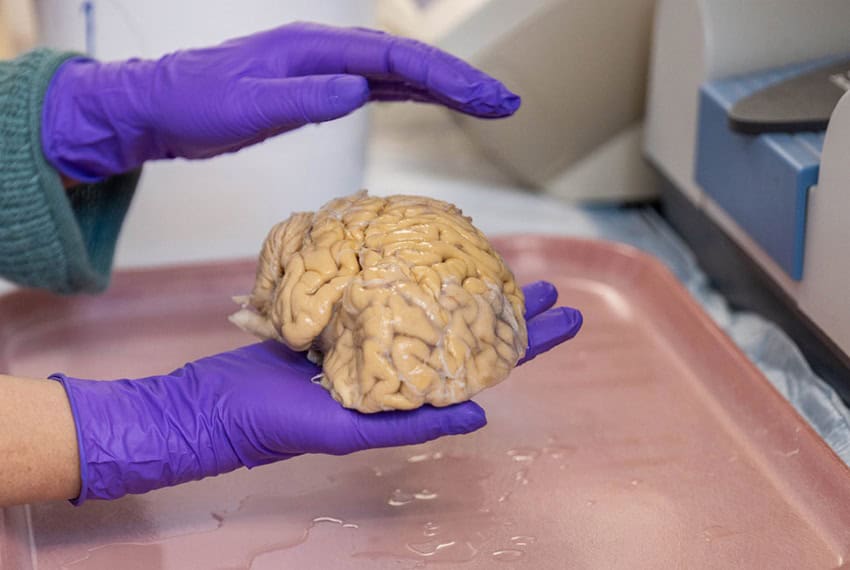 Purple gloved-hands hold a preserved human brain in a lab
