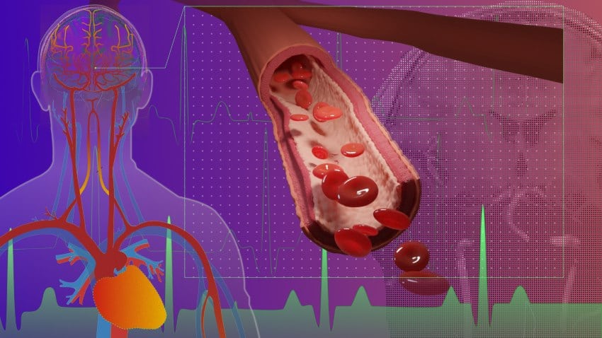 Credit stevens ini 850