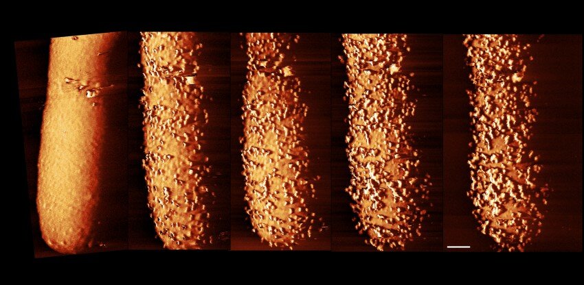 E. Coli exposed to polymyxin showung changes to the outer membrane over time. Credit carolina borrelli edward douglas et al. Nature microbiology 850