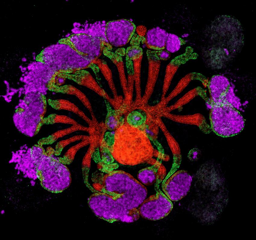 Microscope image of a kidneys organoid crossection. Cells are stained in purple, red and green to denote the different structures of the kidney.