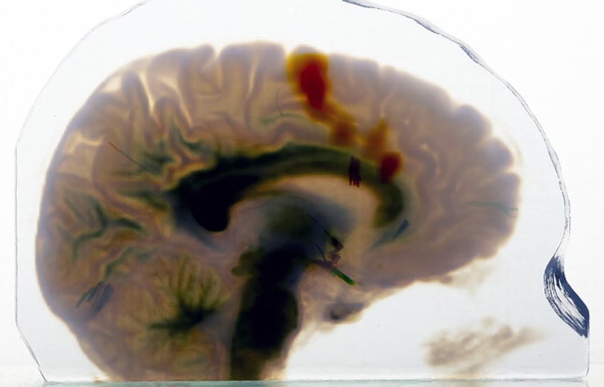 Cross section of a 3d printed model of a human brain with different regions made with differently coloured materials