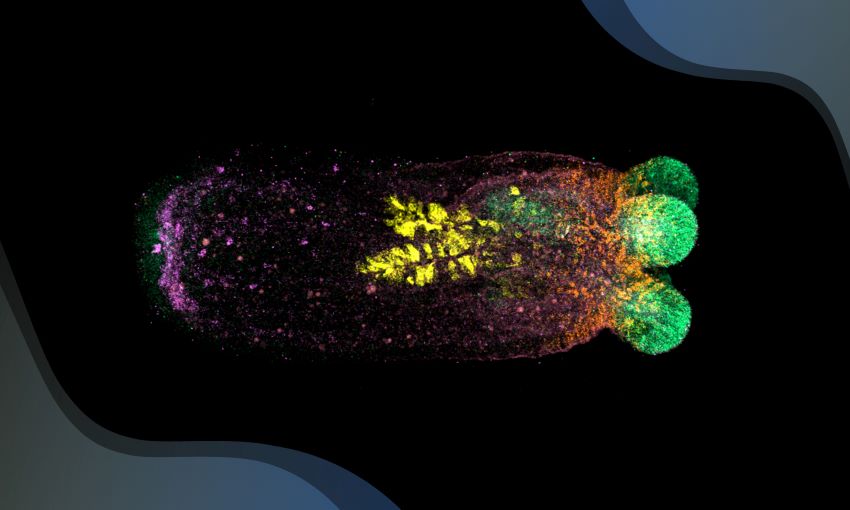 Sea anenome with fluorescent body parts