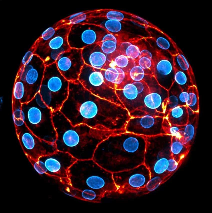 Microscope image of several human embryonic cells clustered into the shape of a ball against a black background. The cells are fluorescing with a blue ball at their centres, and with orange perimeters.