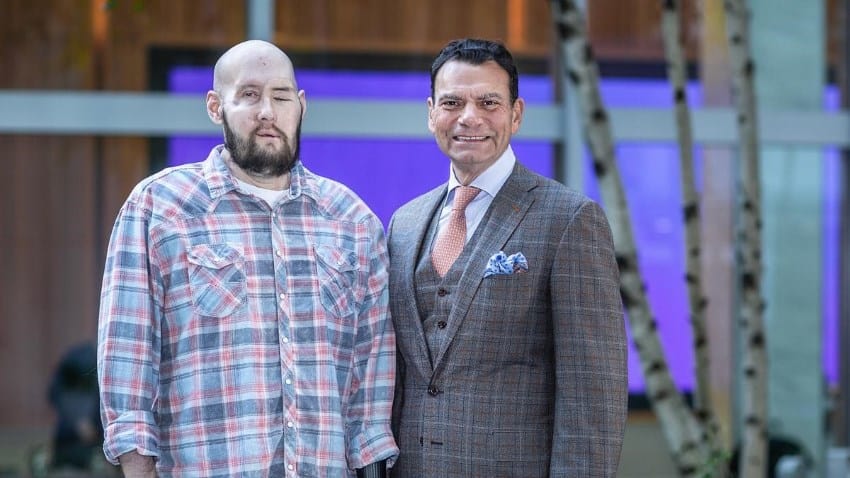A photograph of two men. One is wearing a plaid grey suit and has short dark hair. The other is wearing a plaid red and blue shirt. His left eye and lower face were transplanted. The eye is closed and the skin is a slightly warmer skin tone.