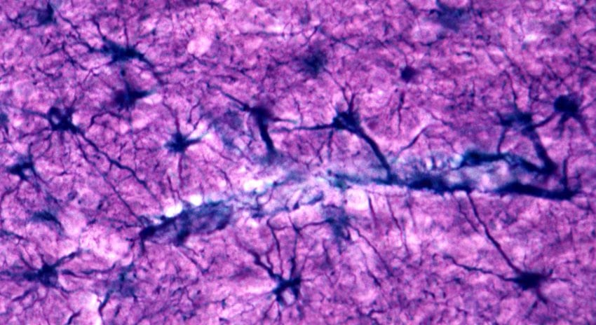 Pink histology slide of a brain showing non-neuron purple star-shaped cells called astrocytes