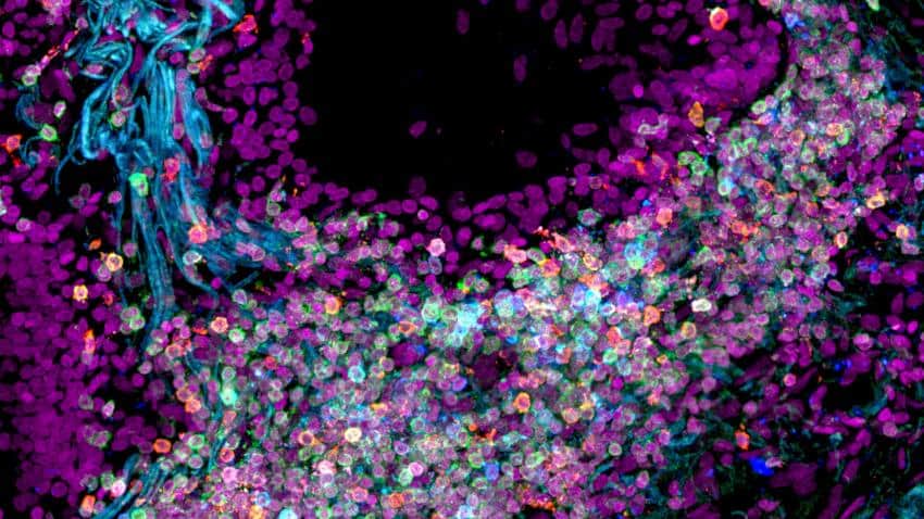 A microscope image of a section of the human lung. The cells are stained with fluorescent colours in blue, purple, green, and pink.