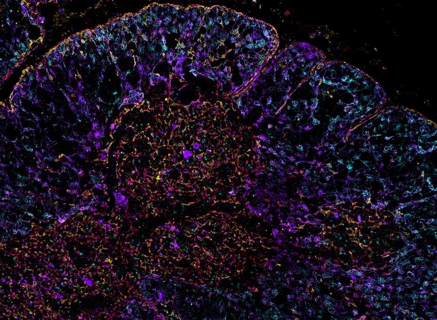 A microscope image of a section of the human thymus. The cells are stained with fluorescent colours in blue, purple, red, and yellow.