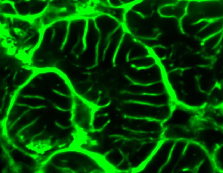 An image of very structured fluorescent green light against black