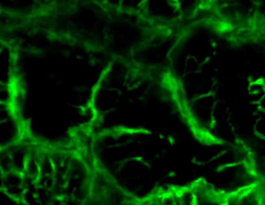 An image of disorganised fluorescent green light against black