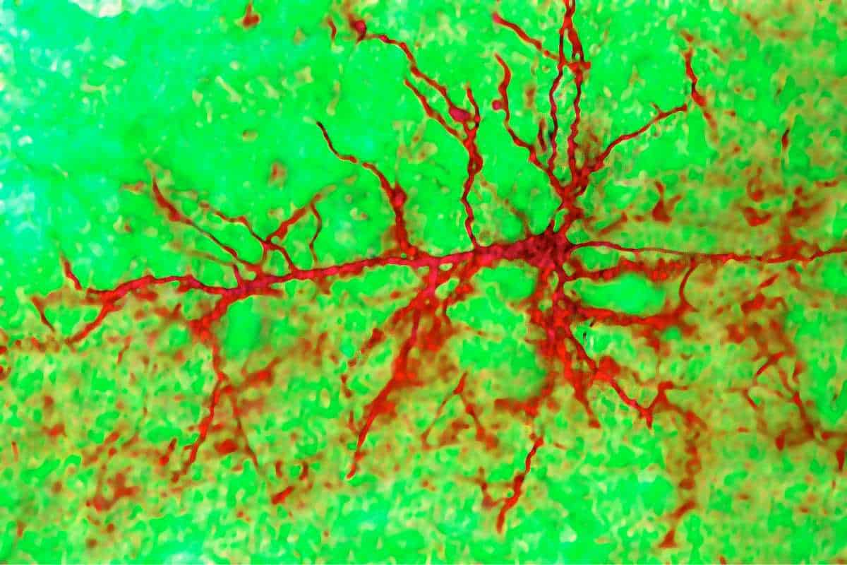 Cerebral Cortical Neuron. Digital Light Microscope.