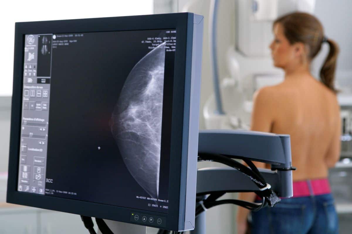 Breast screening. Mammogram