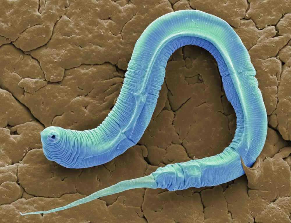 Blue worm, coloured scanning electron micrograph