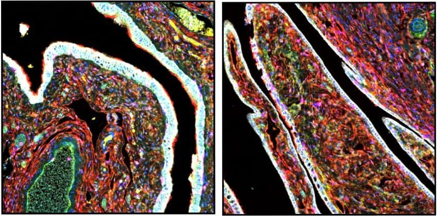 A microscope image of fallopian tube cells stained many different colours