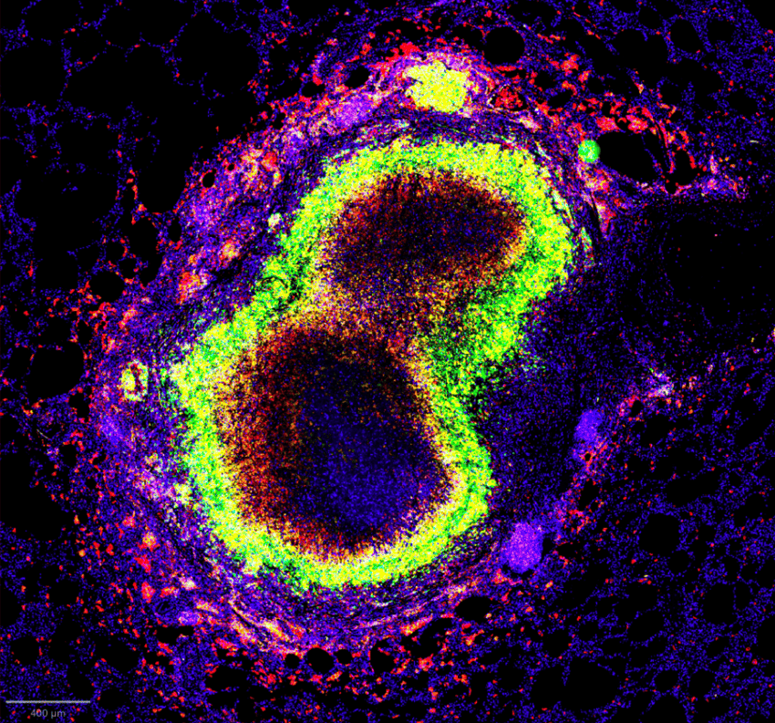 A multi-coloured microscope image showing cells in pinks, blues, red,s and neon green