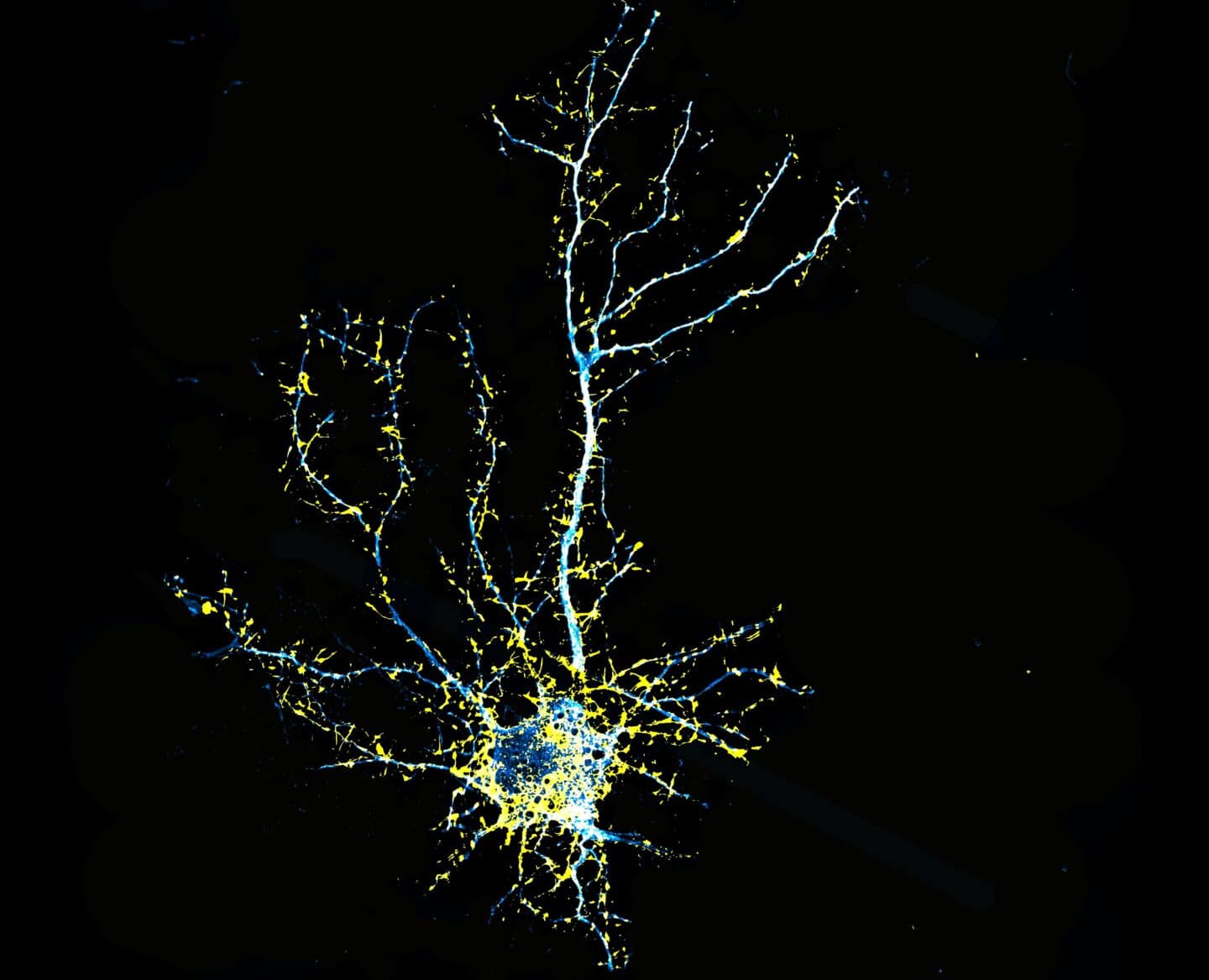 Jrt neuron lee dunlap 850