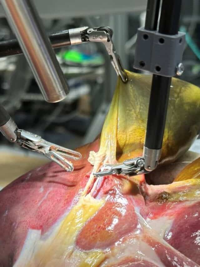 Robot performs gallbladder surgery on a pig