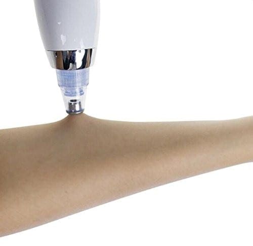 הסוף לראשים השחורים! - מכשיר מקצועי לניקוי עמוק של עור הפנים