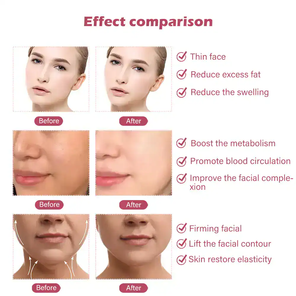 ⁦מכשיר EMS להרזיה הרמה ועיצוב הפנים Face Slimmer Xpro⁩ – תמונה ⁦9⁩