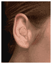 In the Ear (ITE) hearing aid