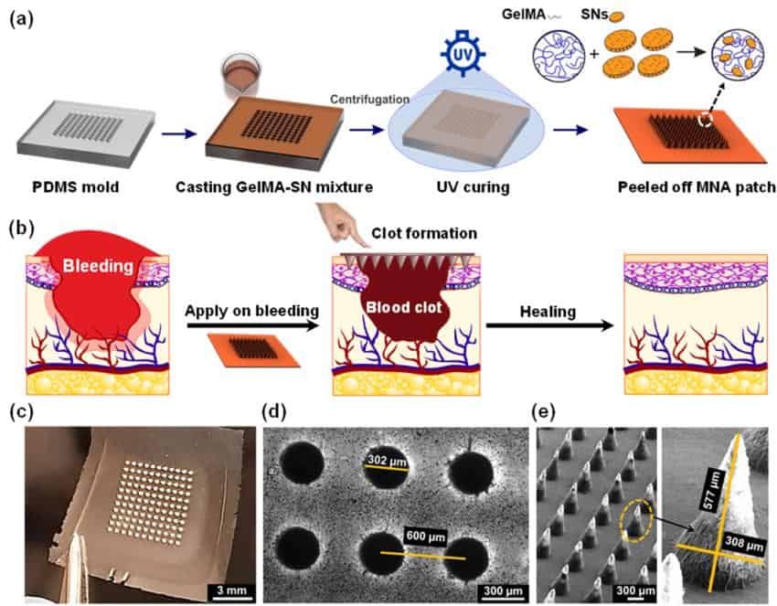 Composite image of diagrams and photographs of the microneedle array fabrication process