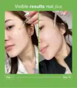 ⁦انوا سيروم الآزليك اسيد المهدئ للبشرة - ٣٠ مل⁩ - الصورة ⁦3⁩