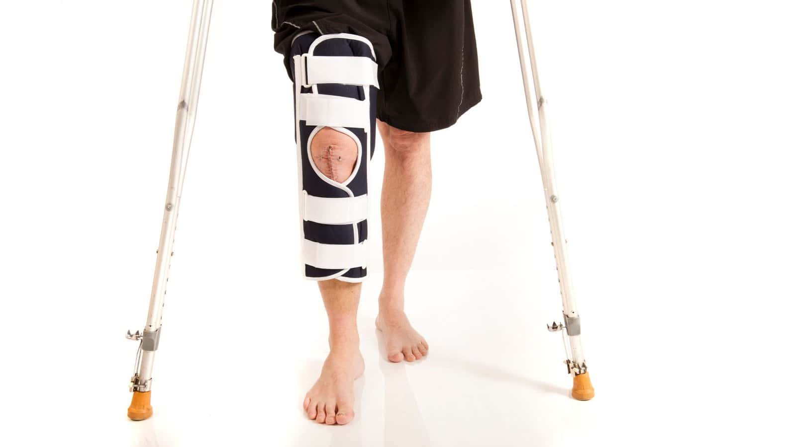 ACL Reconstruction Physiotherapy Protocol Simplified