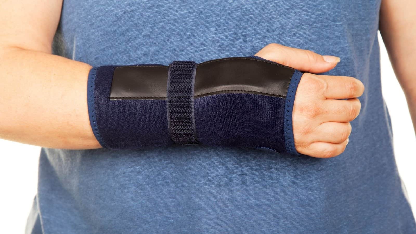 Dummies Guide to Colles' fracture Exercise After Cast Removal