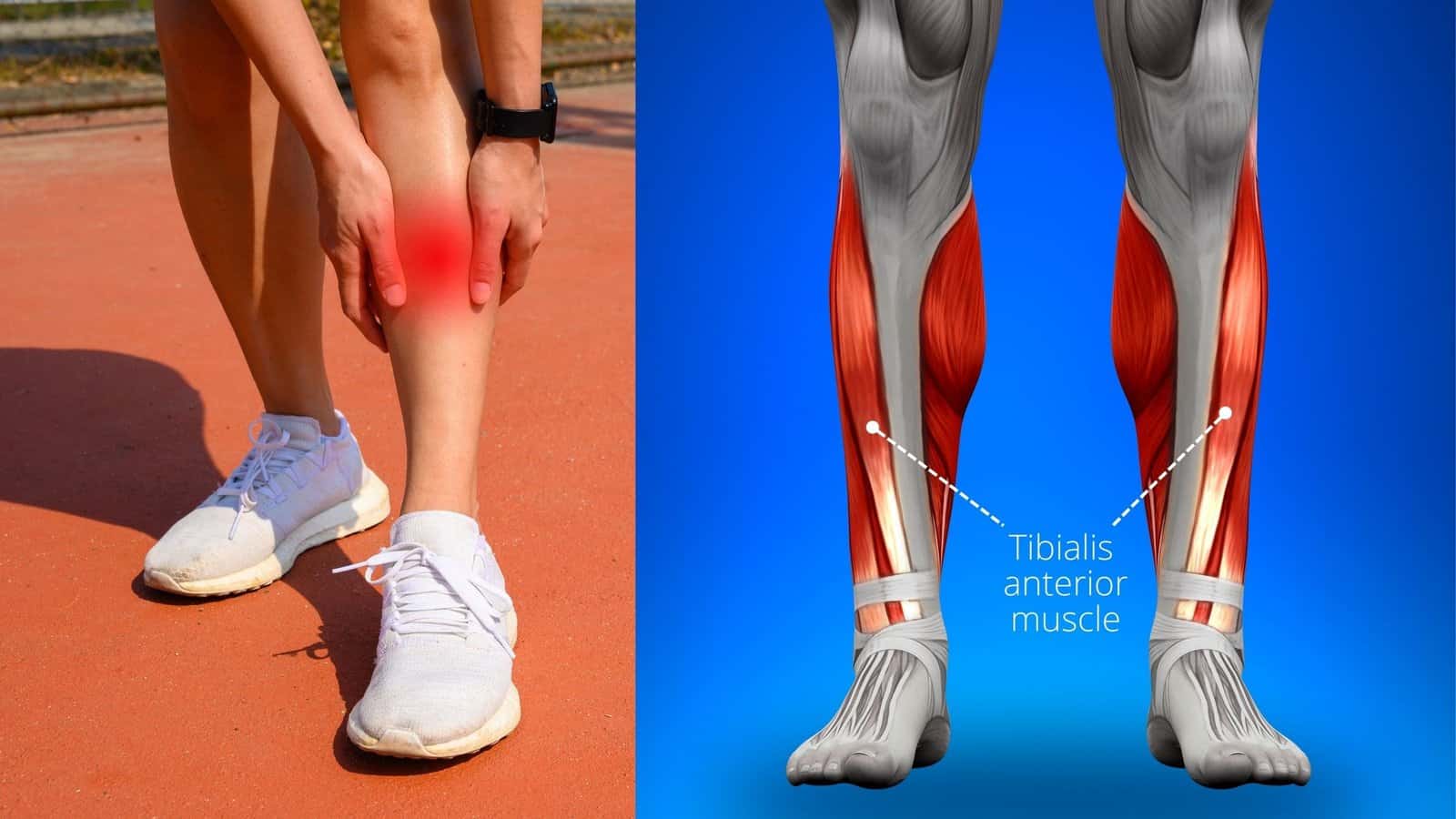 5 Easy Shin Splint Stretches for Pain That Actually Works