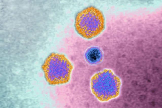 Adenovirus.