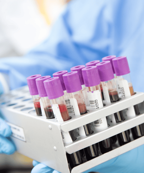 lab technician holding vials of blood
