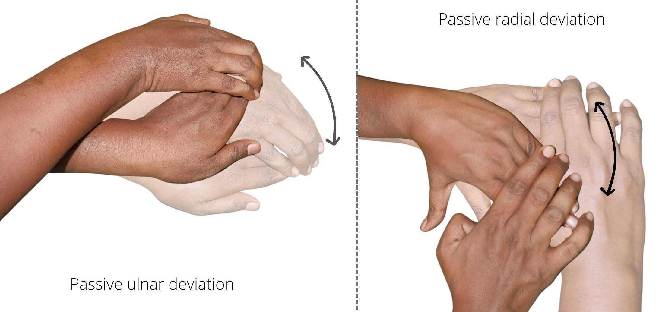 Physiotherapy Exercise Treatment For Scaphoid Fracture Recovery 2964