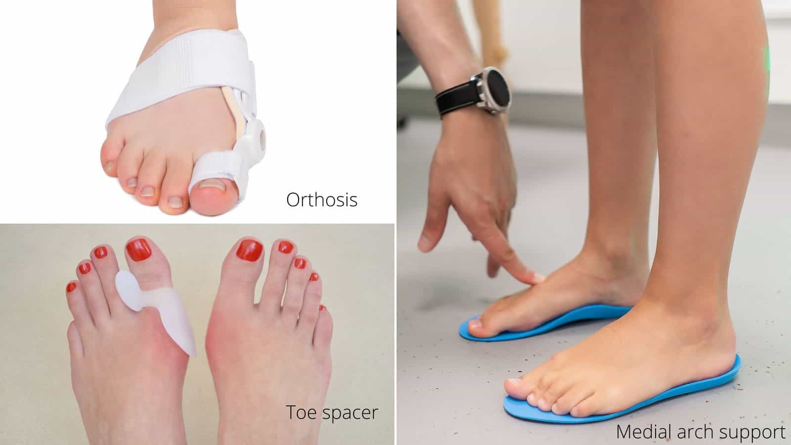 4 Easy Exercises for Hallux Valgus| Bunion Pain Relief in Great Toe