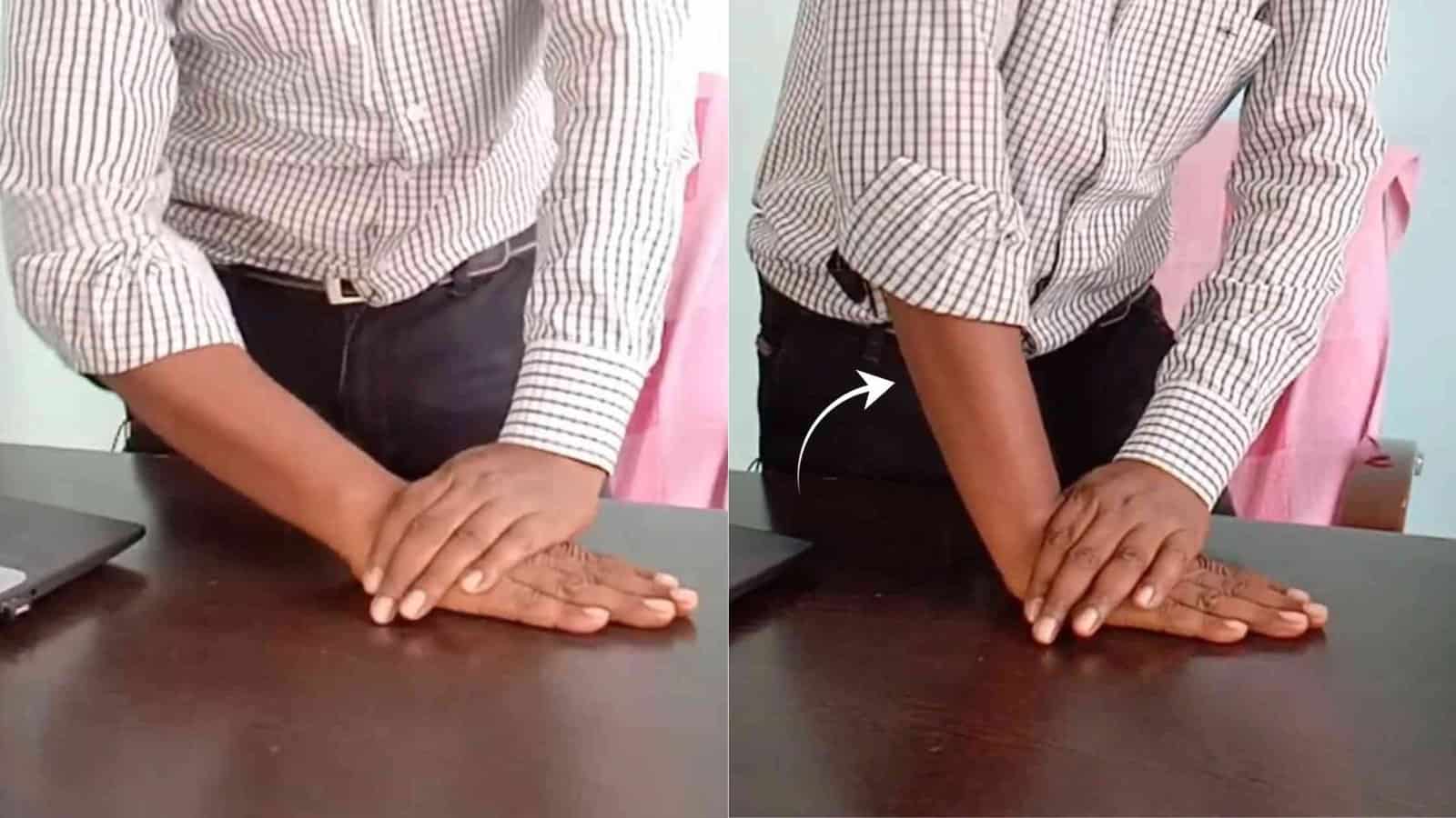 8 Easy Wrist Fracture Rehabilitation Exercises to get back to work early