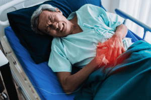 Proliferative Lupus Nephritis Impact on Kidney | pRxEngage
