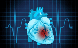 Understanding BAG3-Associated Dilated Cardiomyopathy: A Patient Guide