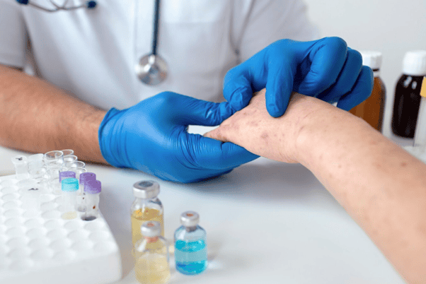 Understanding Systemic Lupus Erythematosus (SLE): A Patient Guide