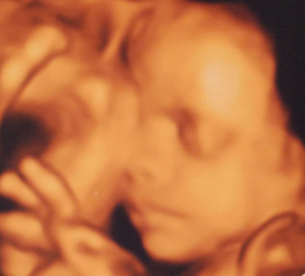 28 weeks pregnant with twins — 4D scan