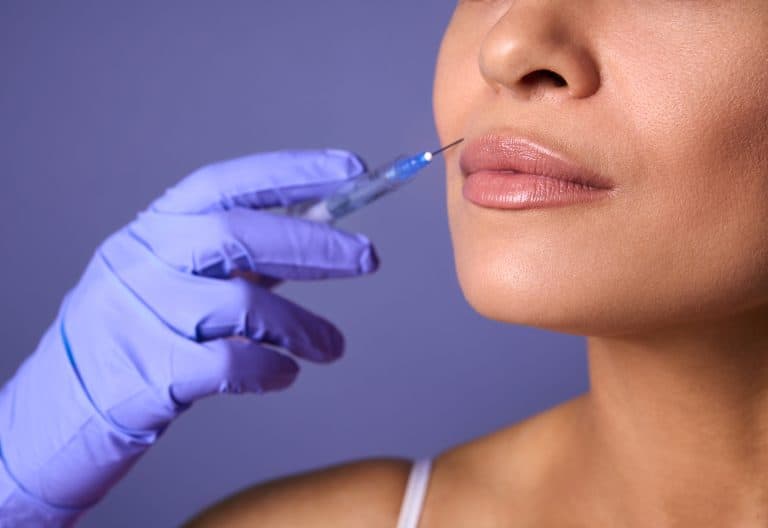Ácido hialurónico labios: resolvemos tus dudas