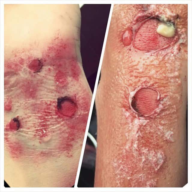 IBI students use liquid latex to create gruesome wounds