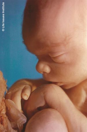 Virginia Governor Issues False Statement Defending Late-Term Abortions