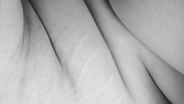 A greyscale close-up photograph of a torso, with prominent curves and rolls, creases and stretch marks on the skin.